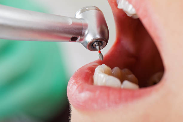 Best Walk-In Emergency Dentist in Heyburn, ID